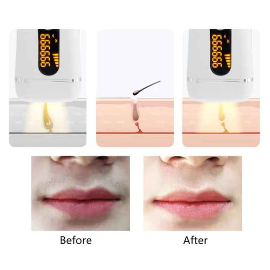 Photonic IPL Laser Hair Removal Instrument Multi-functional Portable Painless Hair Removal Instrument Your Lips Armpits(DYM-011)